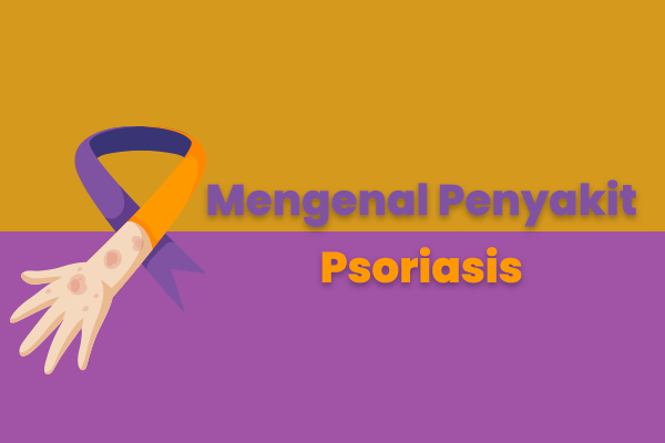 Mengenal Penyakit Psoriasis